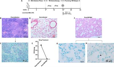 Small Animal Model of Post-chemotherapy Tuberculosis Relapse in the Setting of HIV Co-infection